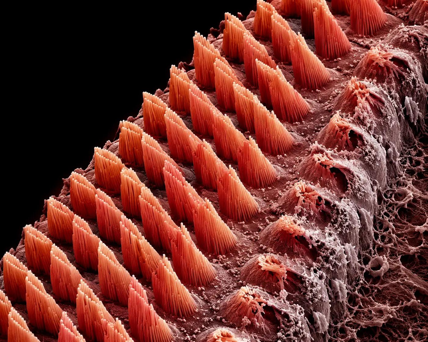 Células ciliadas del oído interno
